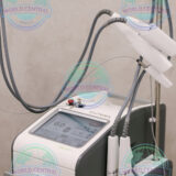 Cutera Excel V+ facial vein removal
