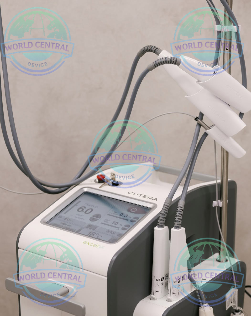 Vascular Lesion Treatment Cutera Excel V+ facial vein removal