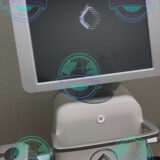 Candela Matrix Pro acne scar treatment with fractional radiofrequency technology