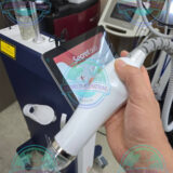 Secret DUO RF microneedling treatment