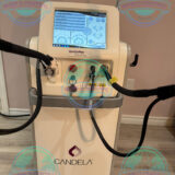 Candela GentleMax Pro Plus vascular and pigmentation treatment laser