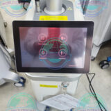 Acne scar treatment using iLooda Fraxis DUO system