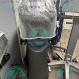 Alma Opus fractional plasma treatment procedure