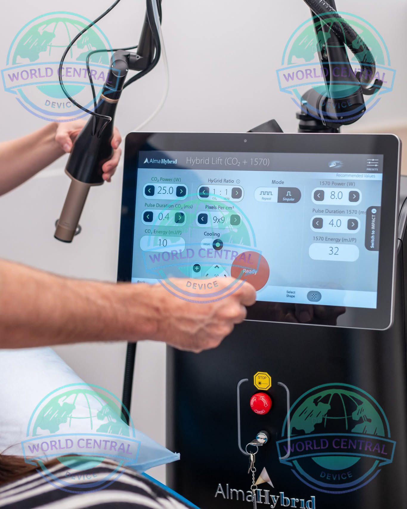 Alma Hybrid ProScan Technology Alma Hybrid ProScan Scanner Handpiece
