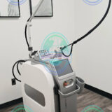 Clarity II laser treatment for vascular lesions spider veins and pigmentation correction