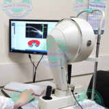 Pentacam HR corneal tomography maps and anterior segment diagnostic analysis